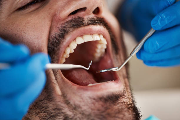 Best Emergency Treatment for Dental Infections or Abscesses in Elsberry, MO